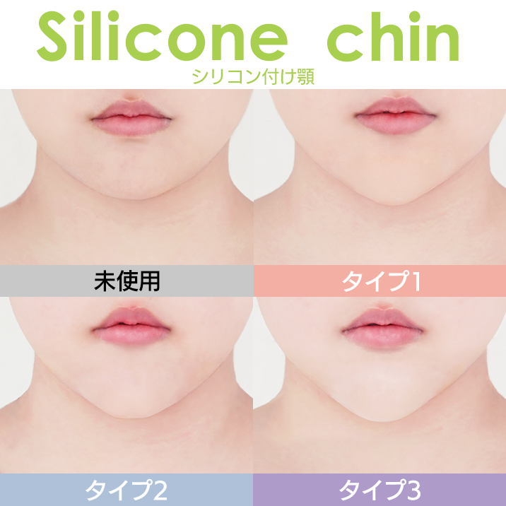★GET THE CHIN OF YOUR DREAM!★3 types of "Silicone Chin" now on sale!!