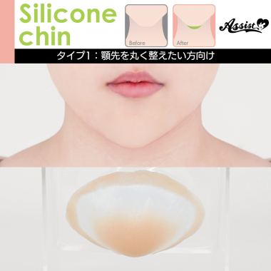 Silicone Chin Type 1